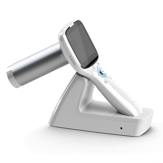 High pixel Hand-held fundus camera