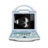 Ophthalmic Ultrasound AB scan OAB-5000 retiwave 1000 AB scan