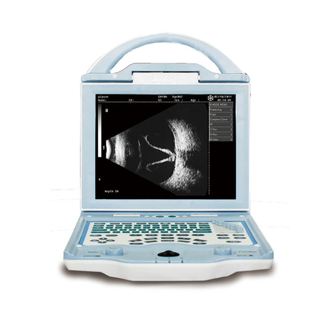 Ophthalmic Ultrasound AB scan OAB-5000 retiwave 1000 AB scan